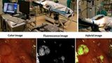 Fluorescence imaging in surgery