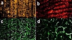 Different layers of human skin obtained with RSOM. 