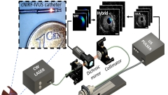 The cNIRF-IVUS imaging system for intravascular through-blood imaging.