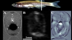 Segment of zebrafish shown by different imaging techniques